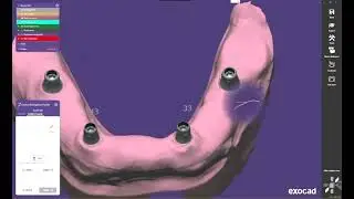 #InatallDentalSoftware #exocad  #freeformplus #blueskyplan  #Onyxceph #codiagnostix   #autoligh