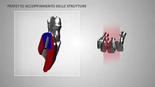 twOne: la rivoluzione in protesi avvitata
