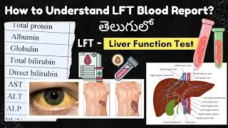 Liver function test in telugu| How to understand liver blood reports| SGOT SGPT AST ALT Bilirubin