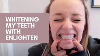Whitening My Teeth with Enlighten