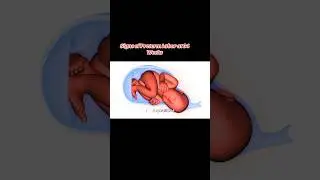 Signs of preterm labor #34weekspregnant #34weeks #pretermbirth #baby