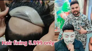 tapping glue method hair patch wig service video in New Delhi Azadpur hair fixing man 7306761493