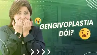 O que é Gengivoplastia? Dói fazer a cirurgia? | Ianara Pinho