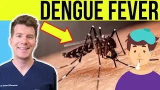 Doctor explains Dengue Fever | Causes, Symptoms, Treatment and Prevention