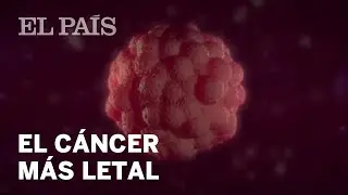La batalla contra el c&aacute;ncer m&aacute;s letal | Espa&ntilde;a