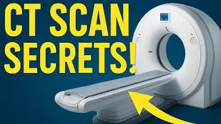CT Scan Basics for Students & Radiographers | Part - 1   #computedtomography 