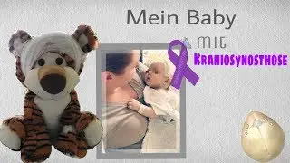 Mein Baby mit Kraniosynostose, craniosynostosis, Kranio, trigonocephalus, Operation, deutsch