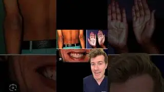 Addison's disease (primary adrenal insufficiency) explained in under 60 seconds #shorts