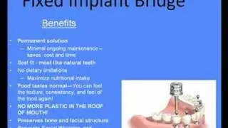 Dental Implants| Replacing Dentures- |Glen Ellyn (near |Chicago)