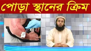 আগুনে পোড়া দাগ দূর করার উপায় | পোড়া দাগ দূর করার ক্রিম | Burn Ointment Cream | Calendumed
