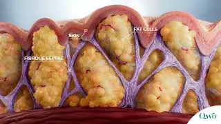 Qwo&reg; Mechanism of Action