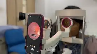 MII Ret Cam with Slit Lamp Mount Fundus Imaging