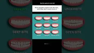 Most people teeth look like this, know about it #protein #healthyfood #healthydiet #dietplan #teeth