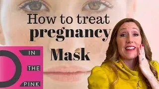 How to treat pregnancy mask.  (Melasma)
