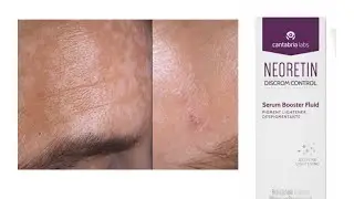 سيروم# neoretin  #تقشير# تنقية #صفاء عناية شاملة # تحفة