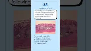 Identify the Causative Agent | Image-Based MCQ | NEET PG