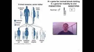 Genetic Sex Linked Diseases