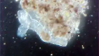 What lives in less than a cap full of pond water. (Looking for tardigrades)