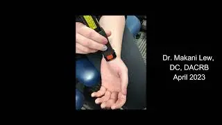 Sprained wrist treatment with laser, tape, and exercises