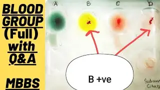 Практический курс по группам крови (полный) с вопросами и ответами | MUHS | #mbbs #медицина #aiim...