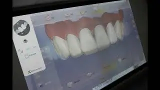 CEREC Asia Workshop【Esthetic Intermediate】