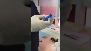 How to modify tray for RPD 2