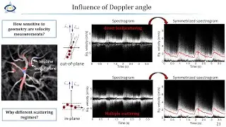 V - Directional blood flow contrast and imaging of blood flow reversal with LDH