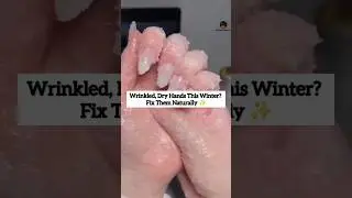 Wrinkled & Dry Hands This Winter? Try This Simple Home Care Hack ❄️✨