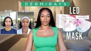 DERMRAYS LED LIGHT MASK REVIEW | 4 Weeks Results & Honest LED Light Therapy Experience