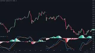 Most Effective MACD Strategy for Daytrading Crypto, Forex & Stocks