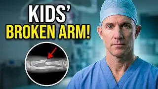 kids fractures - forearm fracture in children - Pediatric Radius and Ulna Fractures (subtitled)