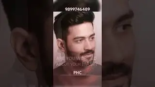 &ldquo;front hair patch for men!&rdquo; #hairpatch #wigs #hairreplacement #hairsystem #hairstyle #haircare #hair
