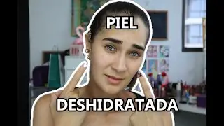 COMO SABER SI TIENES PIEL DESHIDRATADA | CARLA CALVO
