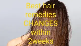 #beauty BEST HAIR OIL|| homemade  hairoil 100% NATURAL INGREDIENTS how to get longhair