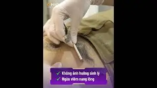 Triệt l&ocirc;ng v&ugrave;ng k&iacute;n bằng c&ocirc;ng nghệ AQUA MAX PRO