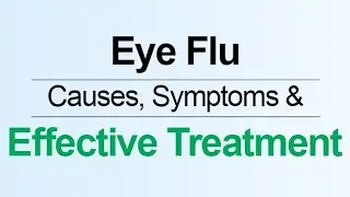What is eye flu virus / Pakistan ma phelny wala virus @healthybearo @healthtime6469 @VIRUS0