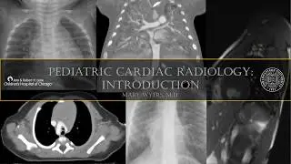 Pediatric Cardiac Radiology Video