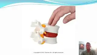 Pain and Pain Management