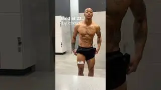 I&rsquo;m bald at 23&hellip; by choice. #rawvlog #gymvibes #baldandblessed #fitnessjourney #shalomiam