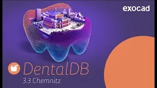 Exocad Chemnitz 3.3 Split Bar