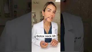 Подтяжка шеи ботоксом #drbitafarrell #botox #necklift