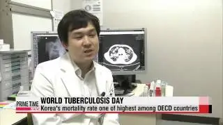 Health ministry increases efforts to eradicate tuberculosis   해마다 신규 결핵환자 OECD 평