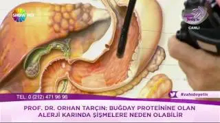 Endoskopi korkusunu yenin!