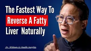 The Fastest Way To Reverse A Fatty Liver Naturally . Dr William Li