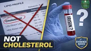 &ldquo;Not Cholesterol&rdquo;: The Irisin Test Claim Explained for Seniors