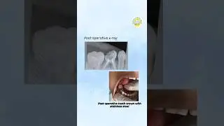 uncooperative patients become cooperative by behaviour management techniques. #childdentist #dentist