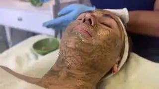 2B Bio Peeling at Richelle Beauty Vision