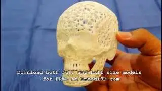 3D printed Lace Skull