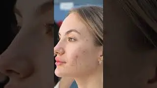 Procollagen Secrets Pro