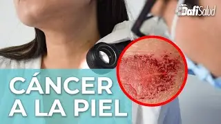 CÁNCER DE PIEL: PROTÉGETE DEL SOL ☀️🚫